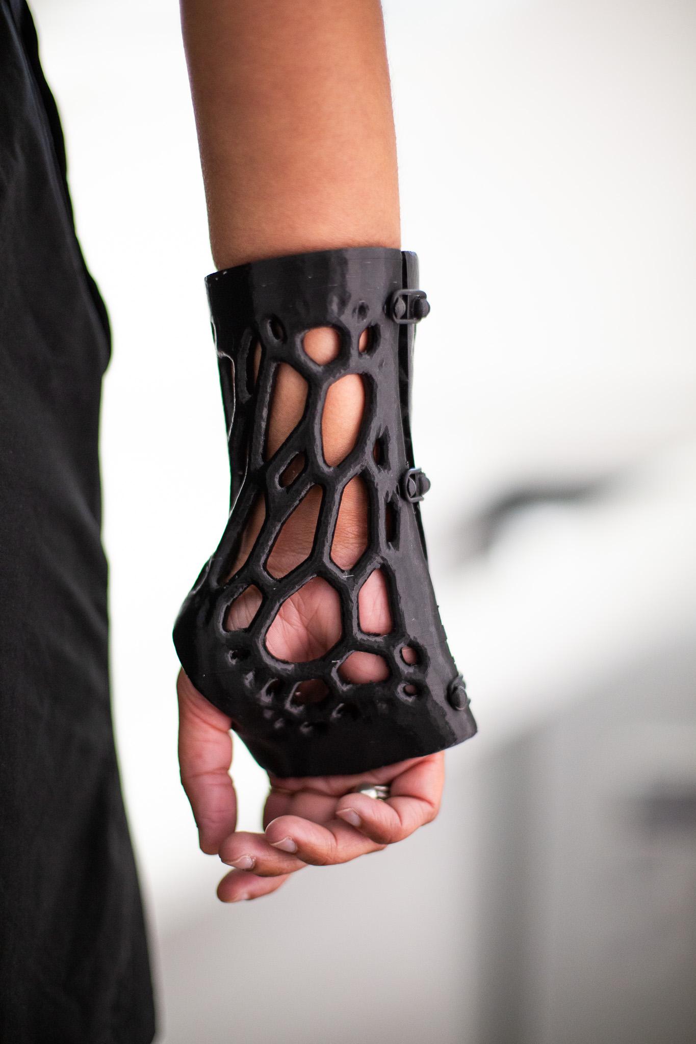 Image for look '3D-Printed Casts Featuring a Voronoi Pattern'